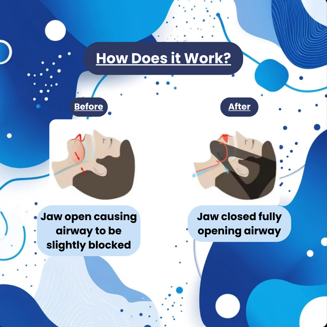 SnoreBand Snoring Chin Strap