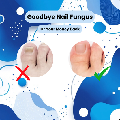 PureNail Nail Fungus Treatment